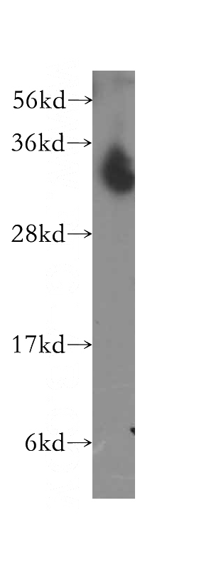 human brain tissue were subjected to SDS PAGE followed by western blot with Catalog No:113400(NTHL1 antibody) at dilution of 1:400