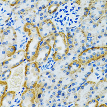 Immunohistochemistry - GDAP1 Polyclonal Antibody 