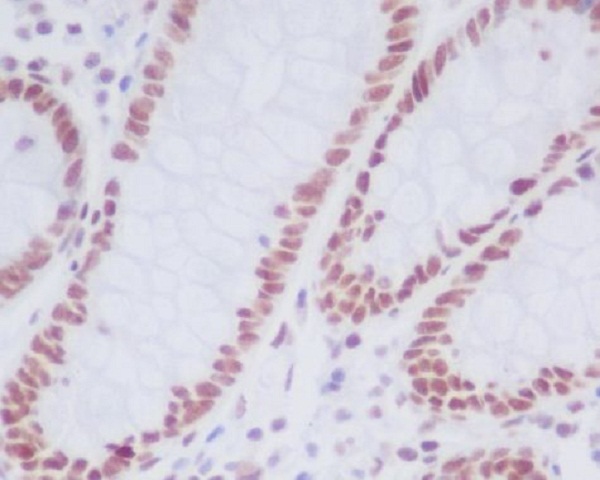 Immunohistochemical analysis of paraffin-embedded human colon, using KDM1/LSD1 Antibody.