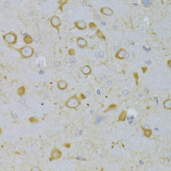 Immunohistochemistry - TSHR Polyclonal Antibody 
