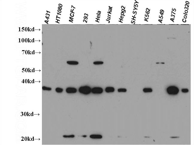 WB results of Catalog No:107593(anti-SMN2).
