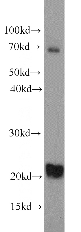 NIH/3T3 cells were subjected to SDS PAGE followed by western blot with Catalog No:116503(TWIST2 antibody) at dilution of 1:500