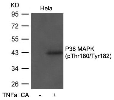 Western blot analysis of extracts from Hela cells untreated or treated with TNFu03b1+CA using P38 MAPK(Phospho-Thr180/Tyr182) Antibody .