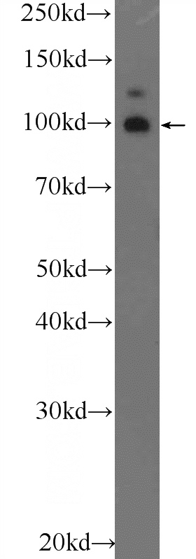 mouse brain tissue were subjected to SDS PAGE followed by western blot with Catalog No:116434(TSHZ3 Antibody) at dilution of 1:600