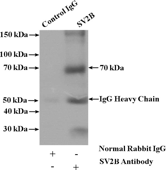 IP Result of anti-SV2B (IP:Catalog No:115754, 4ug; Detection:Catalog No:115754 1:500) with mouse brain tissue lysate 4000ug.