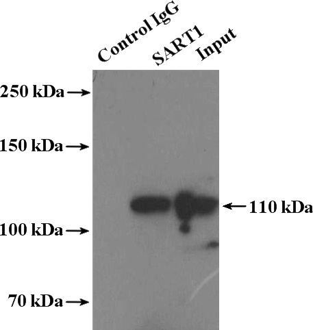 IP Result of anti-SART1 (IP:Catalog No:114972, 4ug; Detection:Catalog No:114972 1:1000) with mouse brain tissue lysate 5200ug.