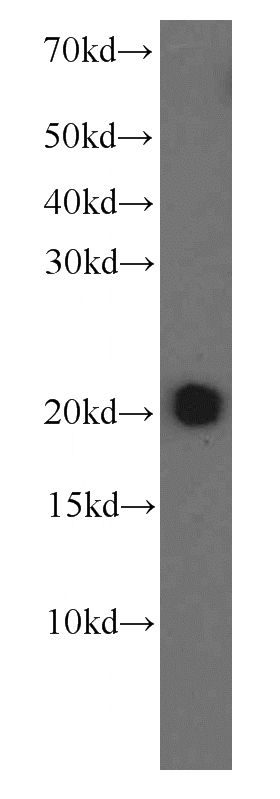 HEK-293 cells were subjected to SDS PAGE followed by western blot with Catalog No:107410(MAD2L1 antibody) at dilution of 1:1000