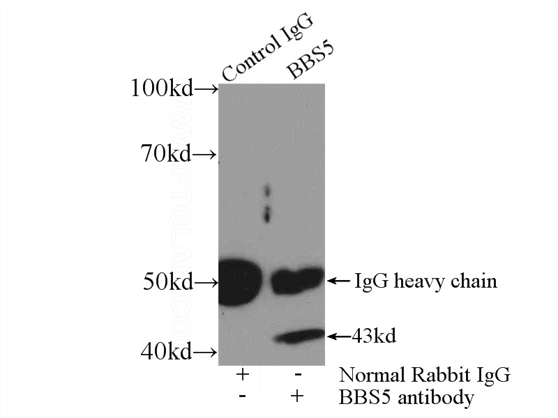 IP Result of anti-BBS5 (IP:Catalog No:108372, 3ug; Detection:Catalog No:108372 1:500) with mouse testis tissue lysate 2800ug.