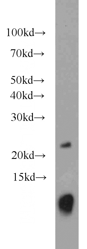 human placenta tissue were subjected to SDS PAGE followed by western blot with Catalog No:116644(URM1 antibody) at dilution of 1:1000