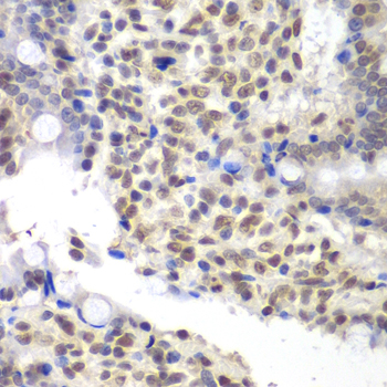 Immunohistochemistry - U2AF1 Polyclonal Antibody 