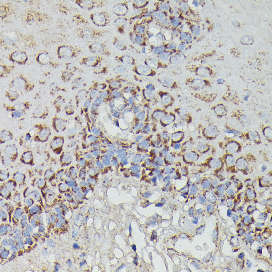 Immunohistochemistry - NDUFAB1 Polyclonal Antibody 