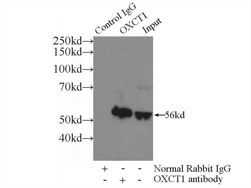 IP Result of anti-SCOT (IP:Catalog No:113524, 3ug; Detection:Catalog No:113524 1:1000) with mouse brain tissue lysate 4000ug.