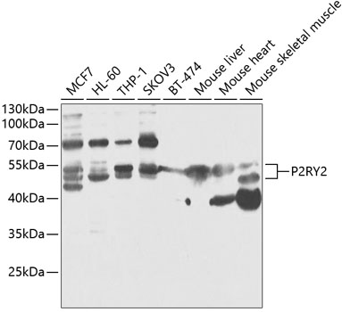 Western blot - P2RY2 Polyclonal Antibody 