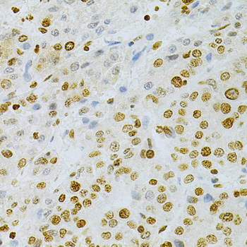 Immunohistochemistry - DKC1 Polyclonal Antibody 