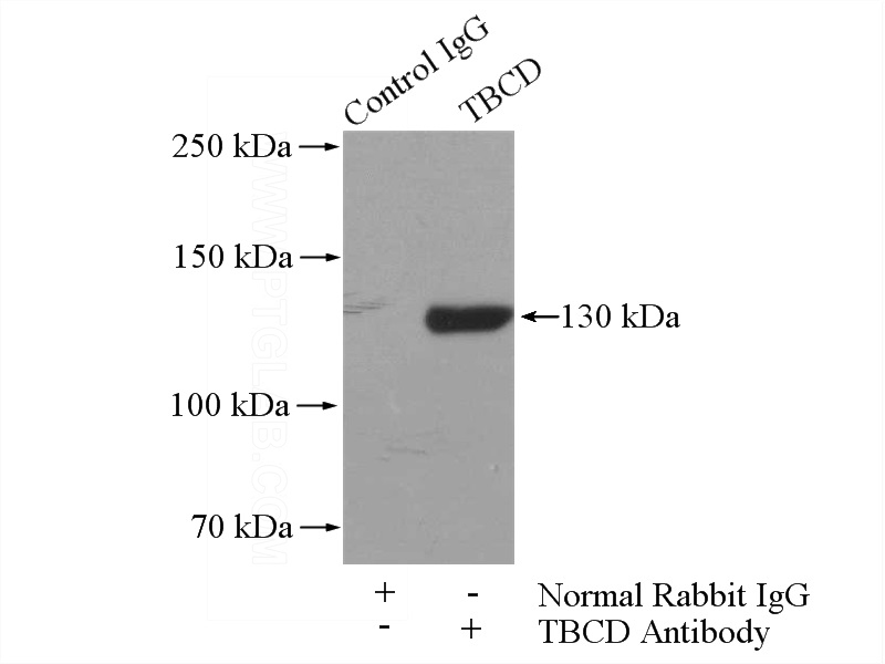 IP Result of anti-TBCD (IP:Catalog No:115872, 4ug; Detection:Catalog No:115872 1:500) with mouse brain tissue lysate 3440ug.