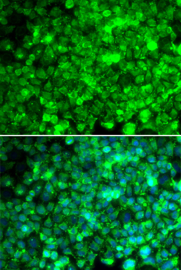 Immunofluorescence - Adiponectin Receptor 1 Polyclonal Antibody 