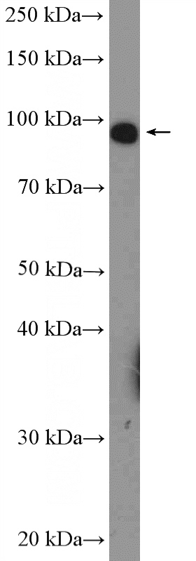 mouse liver tissue were subjected to SDS PAGE followed by western blot with Catalog No:116074(TLR4 Antibody) at dilution of 1:600