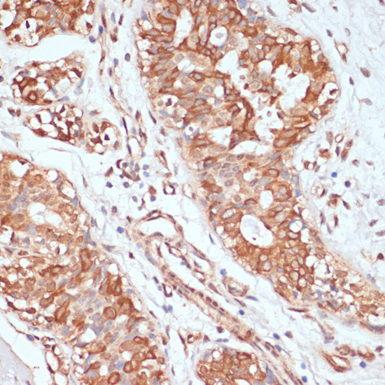 Immunohistochemistry - PTPRN2 Polyclonal Antibody 