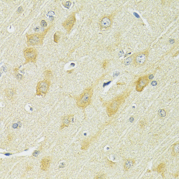 Immunohistochemistry - SLC25A1 Polyclonal Antibody 