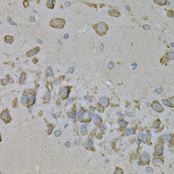Immunohistochemistry - IL10RA Polyclonal Antibody 