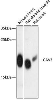 Western blot - CAV3 Polyclonal Antibody 
