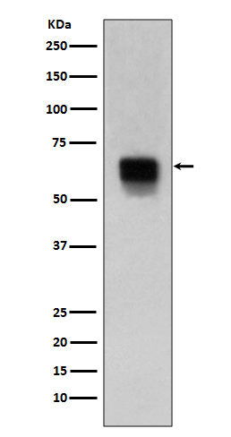 Western blot analysis of MMP14 expression in human spleen lysate.