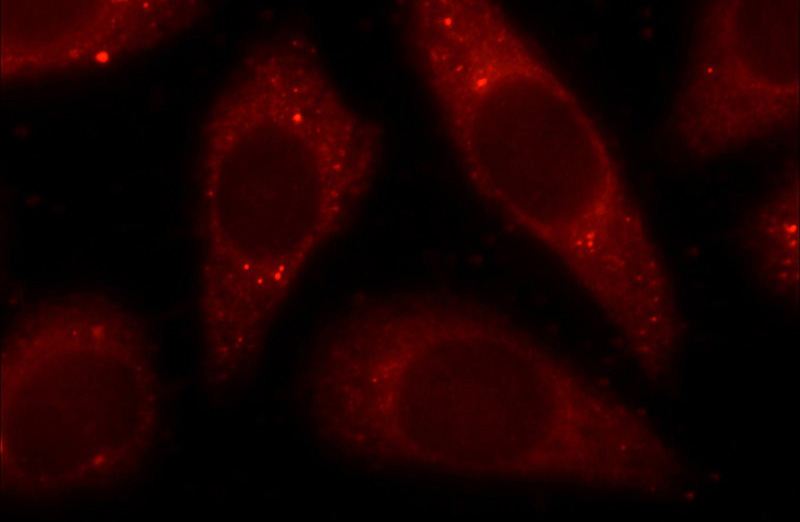 Immunofluorescent analysis of HeLa cells using Catalog No:112129(KRT23 Antibody) at dilution of 1:25 and Rhodamine-Goat anti-Rabbit IgG
