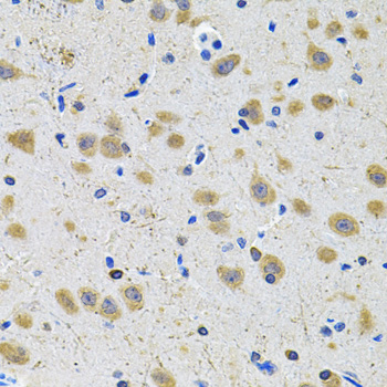 Immunohistochemistry - GRIN1 Polyclonal Antibody 