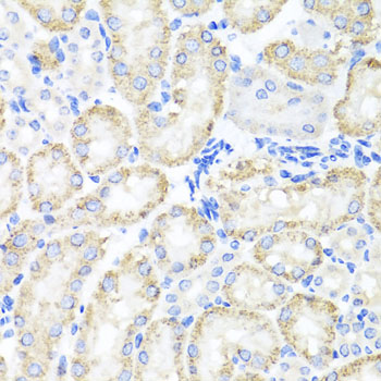 Immunohistochemistry - SPICE1 Polyclonal Antibody 