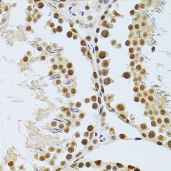 Immunohistochemistry - MTA3 Polyclonal Antibody 