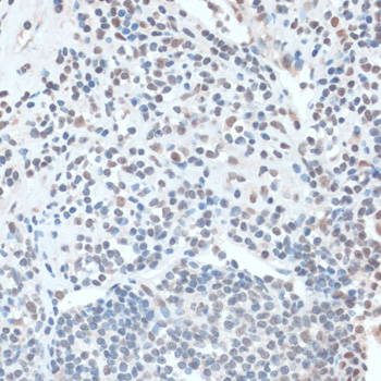 Immunohistochemistry - ZNF433 Polyclonal Antibody 