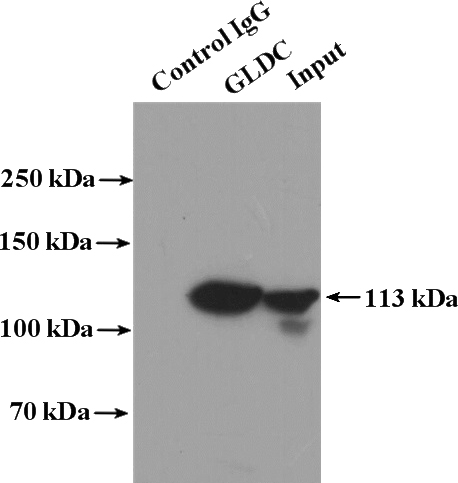 IP Result of anti-GLDC (IP:Catalog No:111020, 4ug; Detection:Catalog No:111020 1:1000) with mouse liver tissue lysate 4000ug.