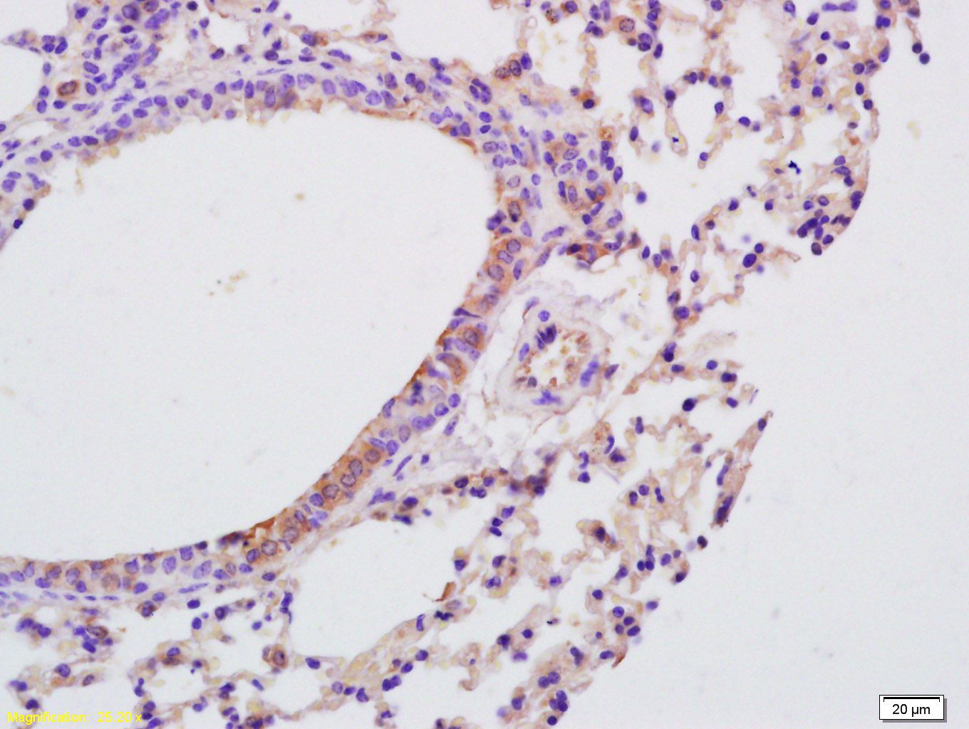 Fig3: Tissue/cell: mouse lung tissue; 4% Paraformaldehyde-fixed and paraffin-embedded;; Antigen retrieval: citrate buffer ( 0.01M, pH 6.0 ), Boiling bathing for 15min; Block endogenous peroxidase by 3% Hydrogen peroxide for 30min; Blocking buffer (normal goat serum,C-0005) at 37℃ for 20 min;; Incubation: Anti-IL-9 Polyclonal Antibody, Unconjugated 1:200, overnight at 4℃, followed by conjugation to the secondary antibody(SP-0023) and DAB(C-0010) staining