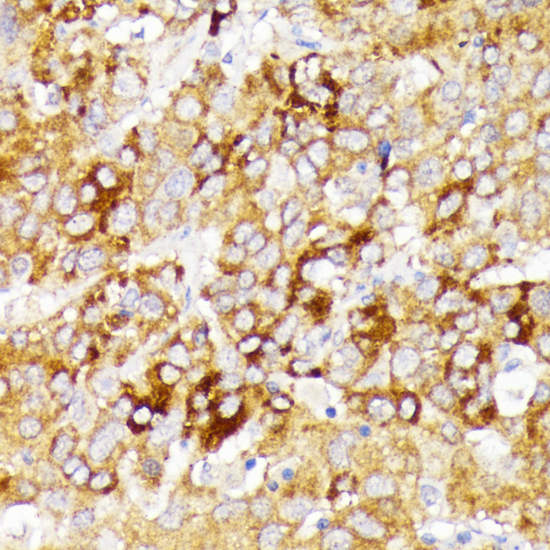 Immunohistochemistry - GALC Polyclonal Antibody 