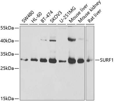 Western blot - SURF1 Polyclonal Antibody 