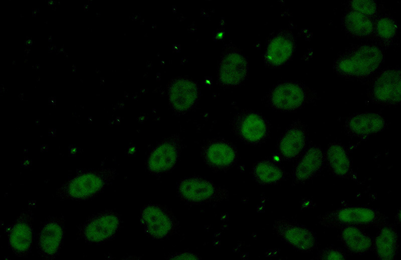 Immunofluorescent analysis of (10% Formaldehyde) fixed HeLa cells using Catalog No:109973(DNTTIP1 Antibody) at dilution of 1:50 and Alexa Fluor 488-congugated AffiniPure Goat Anti-Rabbit IgG(H+L)