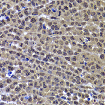Immunohistochemistry - GPS1 Polyclonal Antibody 