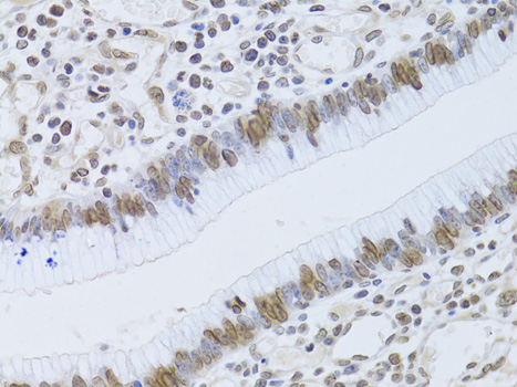 Immunohistochemistry - LMNB2 Polyclonal Antibody 