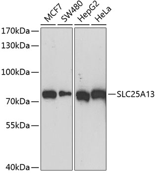 Western blot - SLC25A13 Polyclonal Antibody 