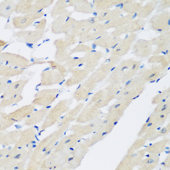 Immunohistochemistry - PLEK Polyclonal Antibody 