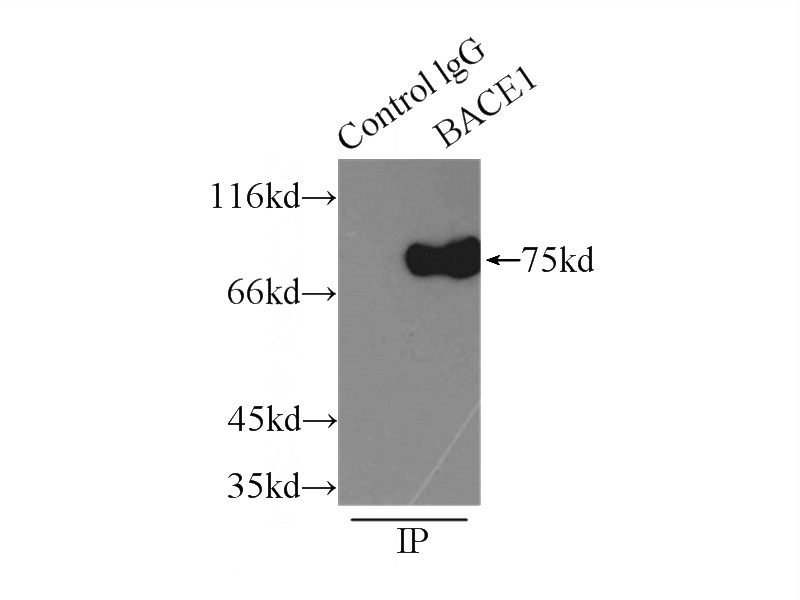 IP Result of anti-BACE1 (IP:Catalog No:108401, 3ug; Detection:Catalog No:108401 1:500) with mouse brain tissue lysate 7500ug.