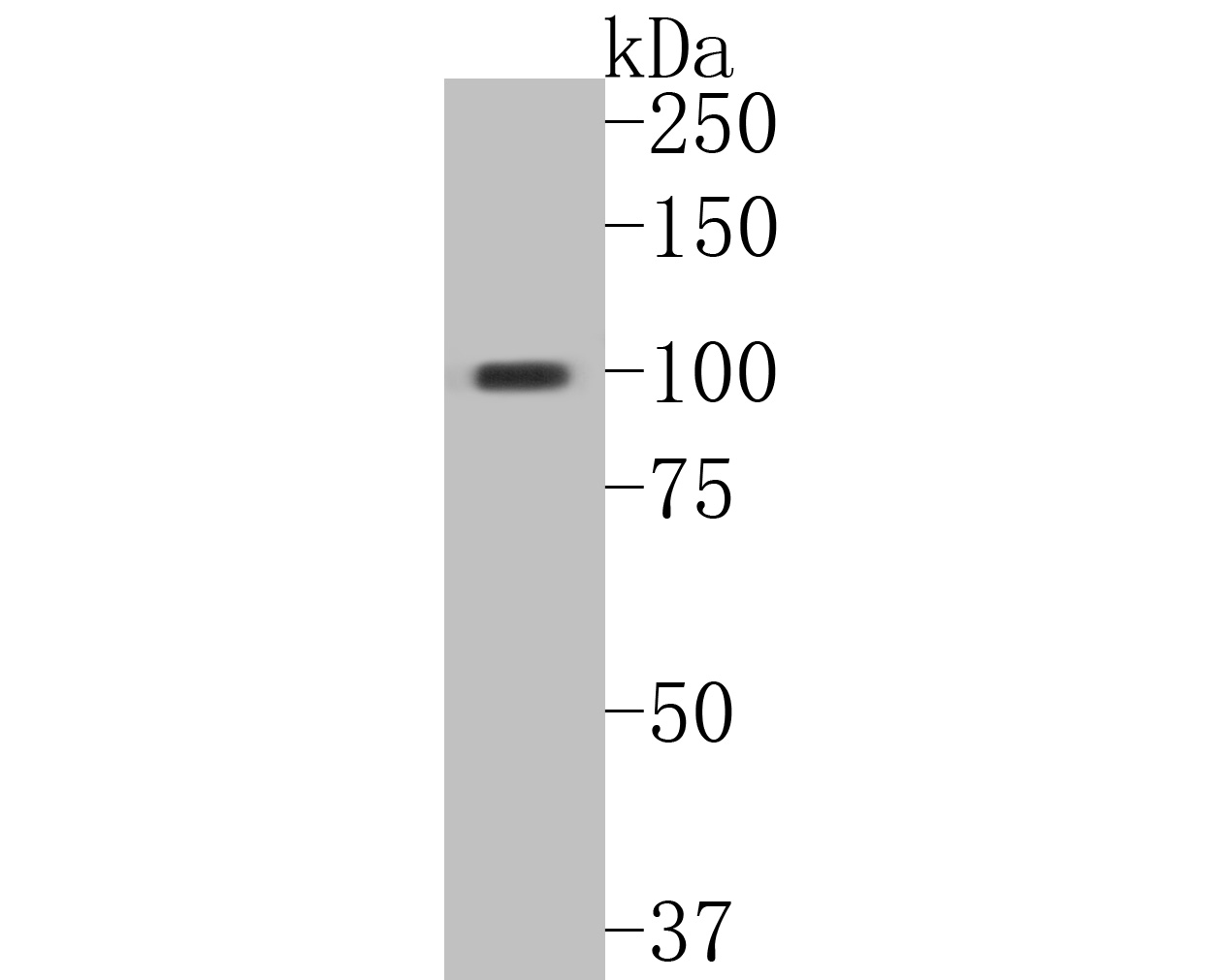 Fig1:; Western blot analysis of DNA2 on human stomach tissue lysates. Proteins were transferred to a PVDF membrane and blocked with 5% BSA in PBS for 1 hour at room temperature. The primary antibody ( 1/500) was used in 5% BSA at room temperature for 2 hours. Goat Anti-Rabbit IgG - HRP Secondary Antibody (HA1001) at 1:5,000 dilution was used for 1 hour at room temperature.
