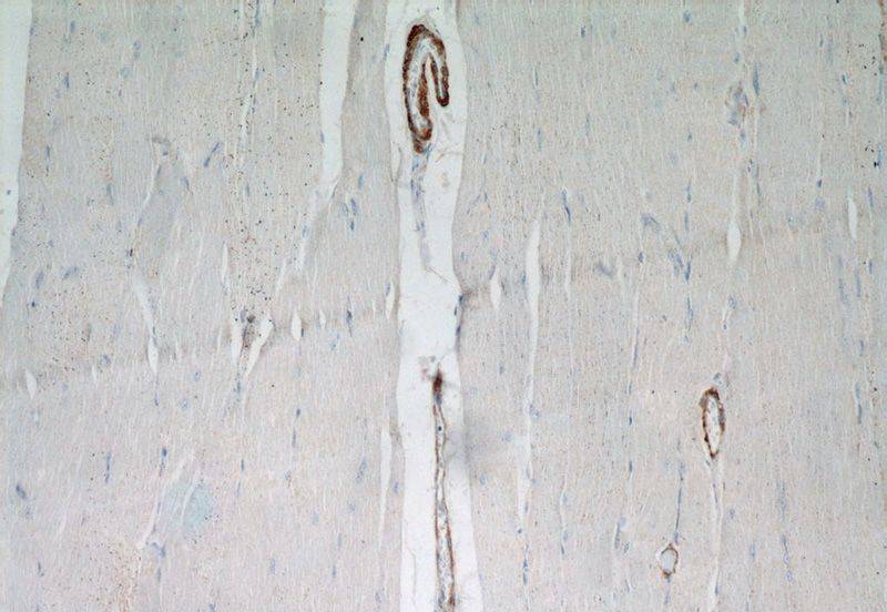 Immunohistochemical of paraffin-embedded human skeletal muscle using Catalog No:115391(MYH11 antibody) at dilution of 1:50 (under 10x lens)