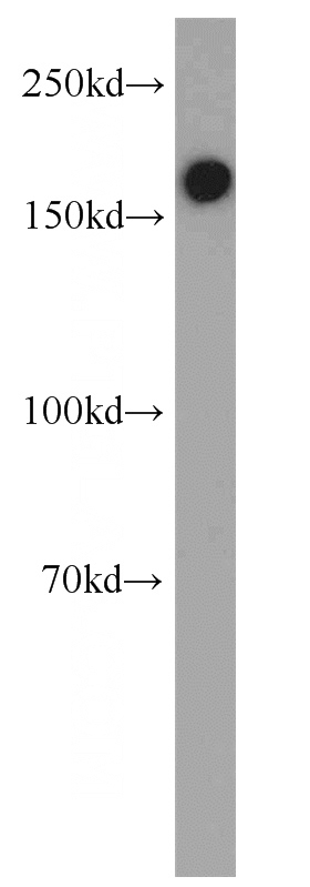 mouse lung tissue were subjected to SDS PAGE followed by western blot with Catalog No:113676(PDGFRB antibody) at dilution of 1:1000