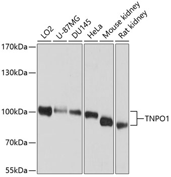 Western blot - TNPO1 Polyclonal Antibody 