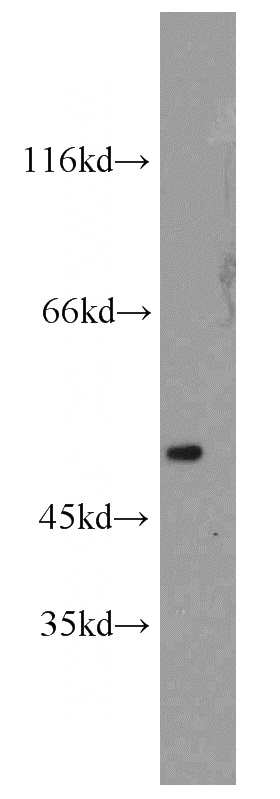 HepG2 cells were subjected to SDS PAGE followed by western blot with Catalog No:115705(STEAP3 antibody) at dilution of 1:2000
