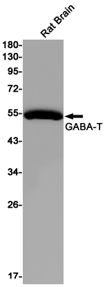 Western blot detection of GABA-T in Rat Brain lysates using GABA-T Rabbit pAb(1:1000 diluted).Predicted band size:56kDa.Observed band size:56kDa.