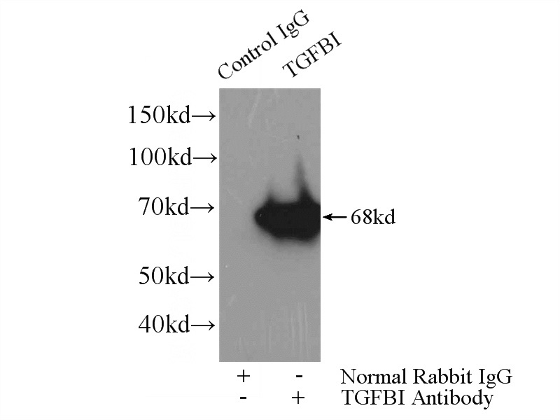 IP Result of anti-BIGH3 (IP:Catalog No:107621, 4ug; Detection:Catalog No:107621 1:300) with HeLa cells lysate 1200ug.