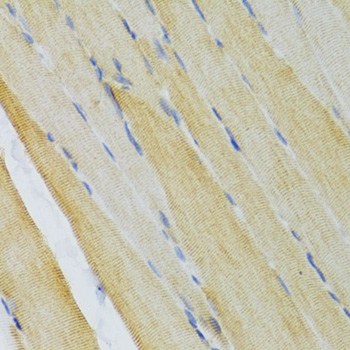 Immunohistochemistry - EDA Polyclonal Antibody 