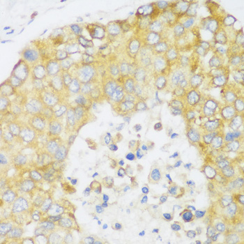 Immunohistochemistry - ERLIN1 Polyclonal Antibody 